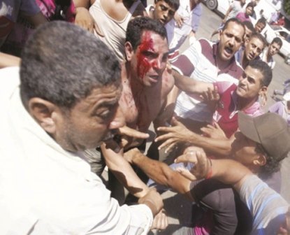 >  أحد مصابي ميدان التحرير أثناء الهجمات عليهم من قبل أنصار مرسي في شارع رمسيس مساء أمس الأول الجمعة